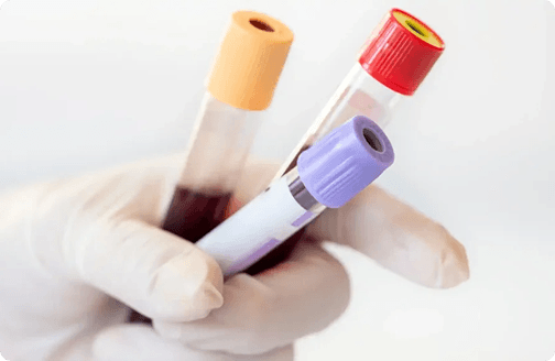 TRT Labs and Total Testosterone | PSA | CBC | FSH and LH – new patients