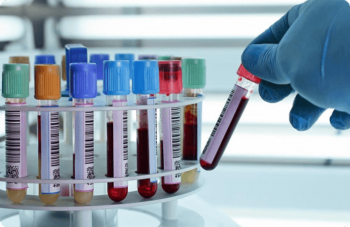 Comprehensive Blood Work Panel